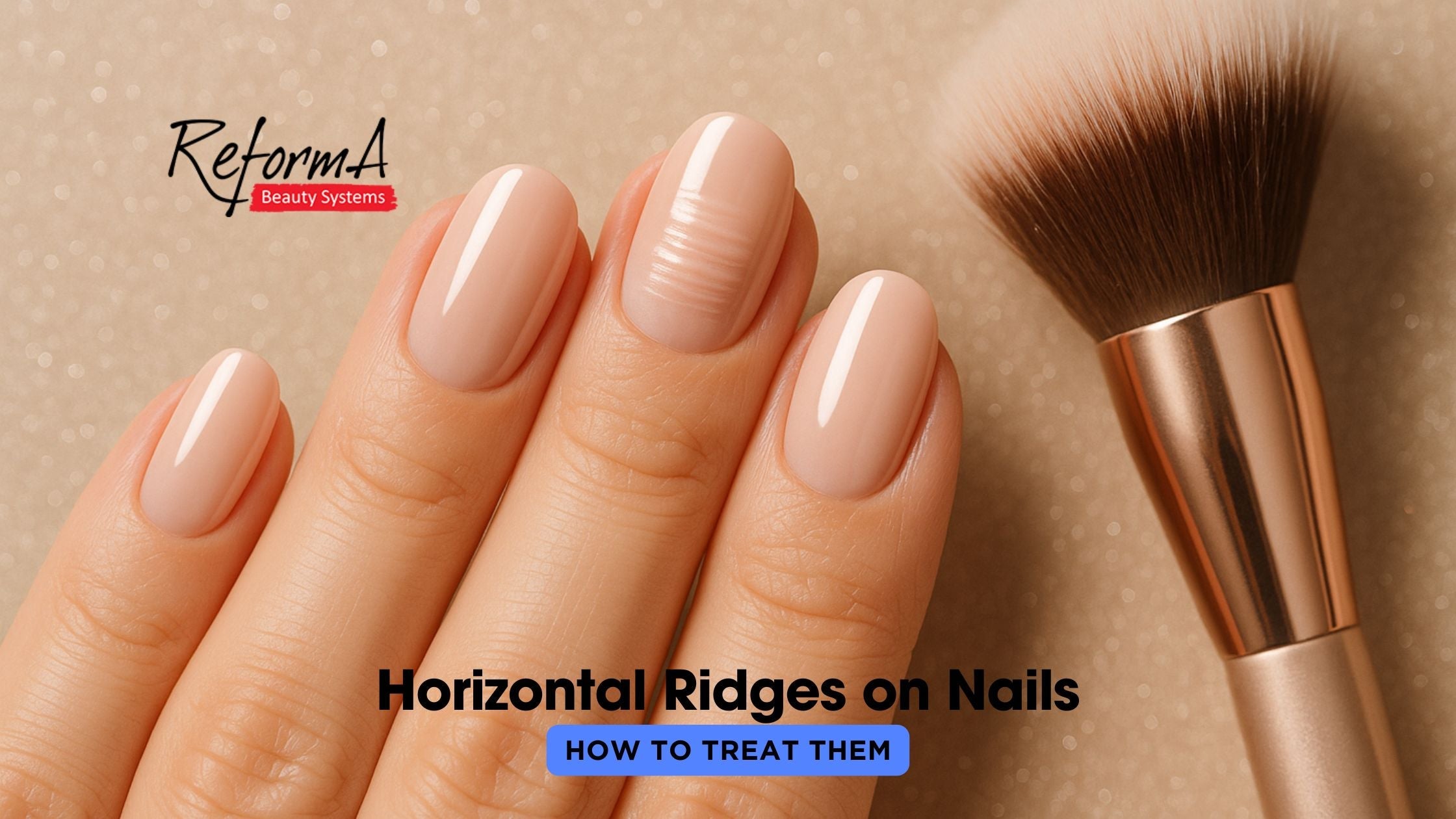 Horizontal Ridges on Nails and How to Treat Them